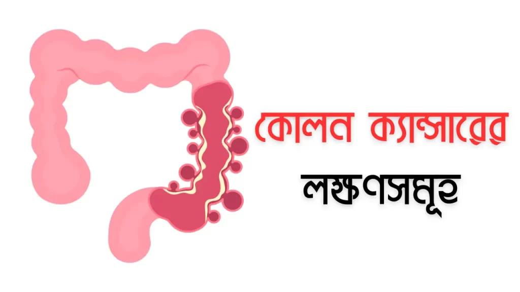 কোলন ক্যান্সারের লক্ষণসমূহ
