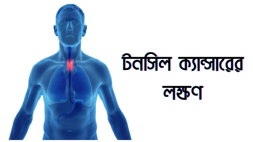 টনসিল ক্যান্সারের লক্ষণ